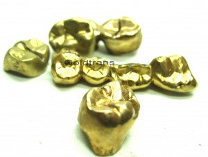 Zahngold schätzen lassen? zahngold_ankauf